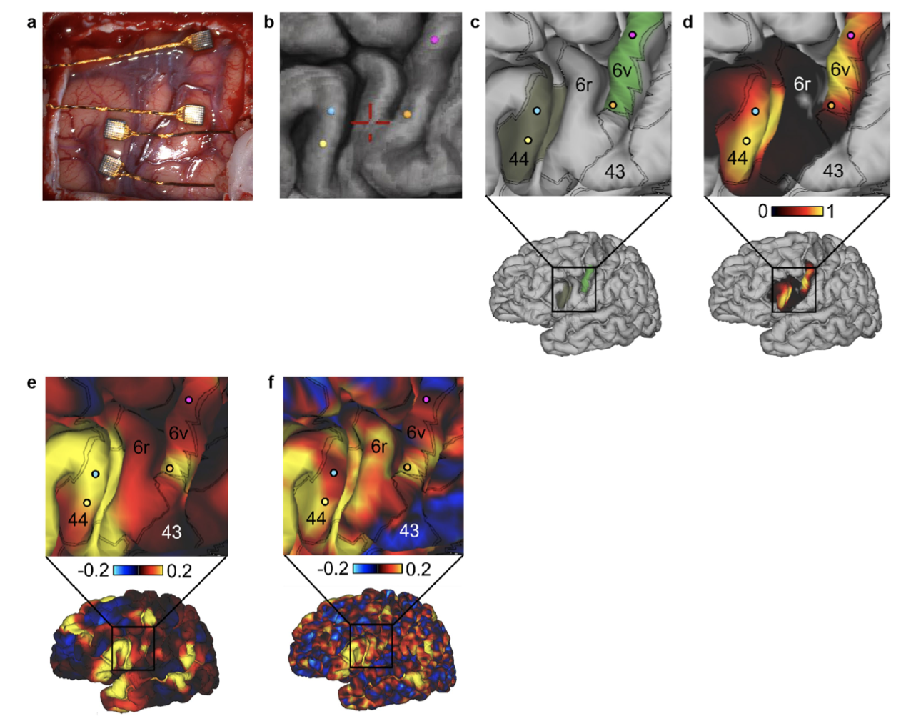 BrainData